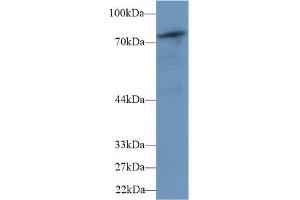 Western blot analysis of Mouse Skeletal muscle lysate, using Human PLCd4 Antibody (1 µg/ml) and HRP-conjugated Goat Anti-Rabbit antibody (