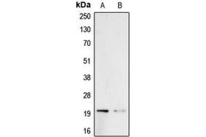 Western blot analysis of Probetacellulin expression in A431 (A), PC3 (B) whole cell lysates. (Betacellulin anticorps  (Center))