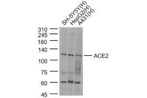 Lane 1: SH-SY5Y cell lysates; Lane 2: HepG2 cell lysates; Lane 3: A431 cell lysates probed with ACE2 Polyclonal Antibody, Unconjugated (bs-23443R) at 1:1000 dilution and 4˚C overnight incubation. (ACE2 anticorps  (AA 451-550))