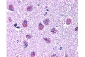 Immunohistochemical (Formalin/PFA-fixed paraffin-embedded sections) staining in human brain with BRS3 polyclonal antibody . (BRS3 anticorps)