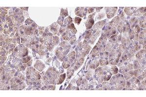 ABIN6273228 at 1/100 staining Human pancreas cancer tissue by IHC-P. (DNAJC19 anticorps  (Internal Region))