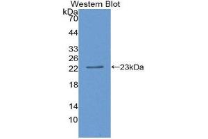 Western Blotting (WB) image for anti-SIVA1, Apoptosis-Inducing Factor (SIVA1) (AA 1-175) antibody (ABIN3202187) (SIVA1 anticorps  (AA 1-175))