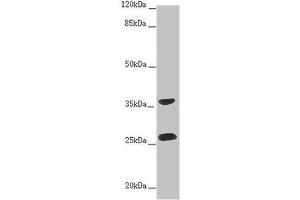 Western blot All lanes: RAB12 antibody at 2 μg/mL + Hela whole cell lysate Secondary Goat polyclonal to rabbit IgG at 1/10000 dilution Predicted band size: 28 kDa Observed band size: 28, 36 kDa (RAB12 anticorps  (AA 98-241))