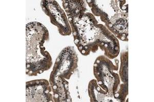 Immunohistochemical staining of human small intestine with FAM134C polyclonal antibody  shows cytoplasmic positivity in glandular cells at 1:50-1:200 dilution.