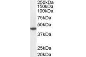 Image no. 1 for anti-Medium-Chain Specific Acyl-CoA Dehydrogenase, Mitochondrial (MCAD) (C-Term) antibody (ABIN374273) (Medium-Chain Specific Acyl-CoA Dehydrogenase, Mitochondrial (MCAD) (C-Term) anticorps)