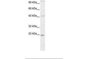 Image no. 2 for anti-High Mobility Group Box 2 (HMGB2) (C-Term) antibody (ABIN6735776) (HMGB2 anticorps  (C-Term))