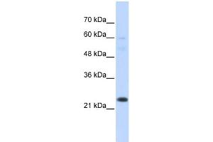 WB Suggested Anti-TAF12 Antibody Titration:  0. (TAF12 anticorps  (N-Term))