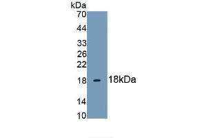 Detection of Recombinant HBEGF, Human using Monoclonal Antibody to Heparin Binding Epidermal Growth Factor Like Growth Factor (HBEGF)
