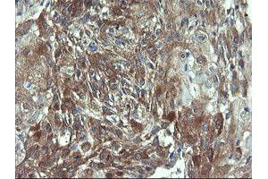 Image no. 4 for anti-Prefoldin Subunit 3 (PFDN3) antibody (ABIN1501704)