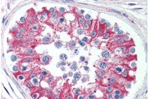 Human Testis (formalin-fixed, paraffin-embedded) stained with SMAD6 antibody ABIN295868 at 5 ug/ml followed by biotinylated goat anti-rabbit IgG secondary antibody ABIN481713, alkaline phosphatase-streptavidin and chromogen. (SMAD6 anticorps  (AA 85-99))