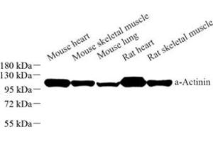 Western blot analysis of Sarcomeric α Actinin (ABIN7075510) at dilution of 1: 1000 (Sarcomeric alpha Actinin anticorps)