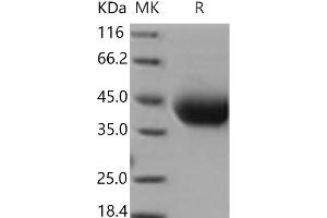 Western Blotting (WB) image for Interleukin 4 Receptor (IL4R) (Active) protein (His tag) (ABIN7196569)