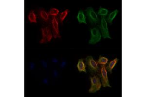 ABIN6259503 and ABIN6273960 staining Hela cells by IF/ICC.