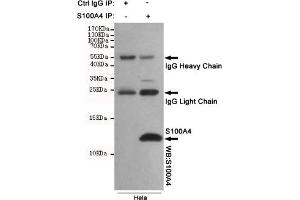 Immunoprecipitation analysis of Hela cell lysates using S100A4 mouse mAb. (s100a4 anticorps)