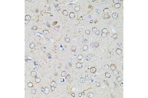 Immunohistochemistry of paraffin-embedded rat brain using BEST1 antibody.