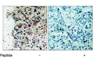 Image no. 1 for anti-Janus Kinase 1 (JAK1) (Tyr1022) antibody (ABIN197300)
