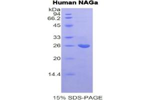 SDS-PAGE of Protein Standard from the Kit (Highly purified E. (NAGA Kit ELISA)
