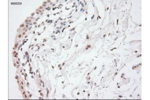 Immunohistochemical staining of paraffin-embedded lung tissue using anti-GAD1mouse monoclonal antibody. (GAD anticorps)