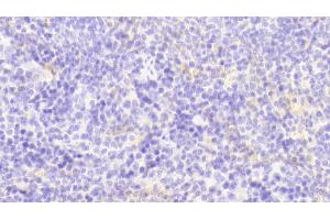 anti-Colony Stimulating Factor 2 (Granulocyte-Macrophage) (CSF2) (AA 19-141) antibody