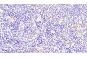 Detection of GM-CSF in Mouse Spleen Tissue using Polyclonal Antibody to Colony Stimulating Factor 2, Granulocyte Macrophage (GM-CSF) (GM-CSF anticorps  (AA 19-141))