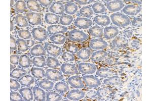 ABIN6255266 and ABIN6277952 at 1/100 staining Rat colon tissue by IHC-P. (PKM2 anticorps  (pSer37))