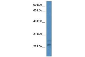 Western Blot showing CBR4 antibody used at a concentration of 1-2 ug/ml to detect its target protein. (CBR4 anticorps  (N-Term))