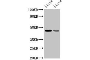 Western Blot Positive WB detected in: Mouse liver tissue, Rat liver tissue All lanes: DDB2 antibody at 4. (DDB2 anticorps  (AA 1-185))