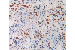 Used in DAB staining on fromalin fixed paraffin- embedded lung tissue (IL1RAP anticorps  (AA 65-249))