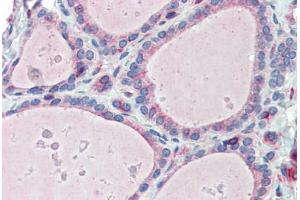 Anti-ESYT1 / FAM62A antibody  ABIN960776 IHC staining of human thyroid.