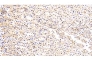 Detection of LAMa2 in Mouse Stomach Tissue using Polyclonal Antibody to Laminin Alpha 2 (LAMa2) (Laminin anticorps  (AA 2901-3106))