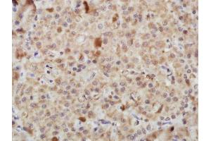 Paraformaldehyde-fixed, paraffin embedded rat pancreas tissue, Antigen retrieval by boiling in sodium citrate buffer(pH6) for 15min, Block endogenous peroxidase by 3% hydrogen peroxide for 30 minutes, Blocking buffer (normal goat serum) at 37°C for 20min, Antibody incubation with Rabbit Anti-PERK (Thr980) Polyclonal Antibody, Unconjugated  at 1:400 overnight at 4°C, followed by a conjugated secondary and DAB staining