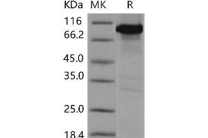 Western Blotting (WB) image for Calcium/calmodulin-Dependent Protein Kinase IV (CAMK4) protein (GST tag,His tag) (ABIN7320129)