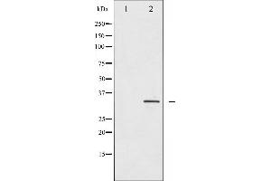 Western blot analysis of IGFBP-3 expression in HuvEc whole cell lysates,The lane on the left is treated with the antigen-specific peptide. (IGFBP3 anticorps  (Internal Region))