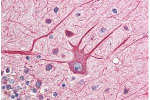 Human Brain, Cerebellum (formalin-fixed, paraffin-embedded) stained with EIF2AK2 antibody ABIN214488 at 2. (EIF2AK2 anticorps  (C-Term))