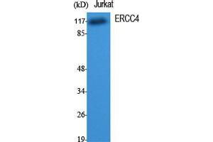 Western Blot (WB) analysis of specific cells using ERCC4 Polyclonal Antibody. (ERCC4 anticorps  (C-Term))