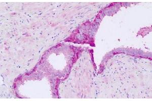 Human, Prostate: Formalin-Fixed Paraffin-Embedded (FFPE) (GPR56 anticorps  (N-Term))