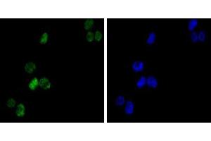 Immunofluorescence analysis of K562(left) cells using GATA1 mouse mAb (green). (GATA1 anticorps)