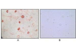 Immunocytochemistry analysis of TPA induced BCBL-1 cells (A) and uninduced BCBL-1 cells (B) using KSHV K8a antibody with AEC staining. (KSHV K8 alpha anticorps)