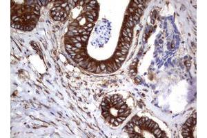 Image no. 15 for anti-Tumor Necrosis Factor Receptor Superfamily, Member 8 (TNFRSF8) (AA 19-379) antibody (ABIN1491084)