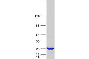 Validation with Western Blot