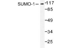 Image no. 1 for anti-Small Ubiquitin Related Modifier Protein 1 (SUMO1) antibody (ABIN271962) (SUMO1 anticorps)