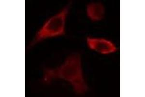 ABIN6275359 staining Hela cells by IF/ICC. (Phospholipase D4 anticorps  (C-Term))
