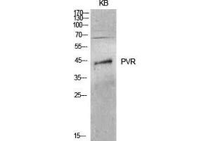 Western Blot (WB) analysis of KB cells using CD155 Polyclonal Antibody. (Poliovirus Receptor anticorps  (Internal Region))