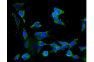 Immunofluorescence staining of undifferentiated SH-SY5Y cells (Human neuroblastoma, ATCC CRL-2266) (left) and differentiated SH-SY5Y cells (right). (GRIP1 anticorps  (AA 877-1067))