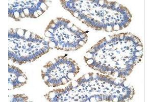 Image no. 1 for anti-Splicing Factor 3b, Subunit 4, 49kDa (SF3B4) (N-Term) antibody (ABIN202492)