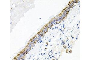 Immunohistochemistry of paraffin-embedded Human lung using ACVR2A Polyclonal Antibody at dilution of 1:100 (40x lens). (ACVR2A anticorps)