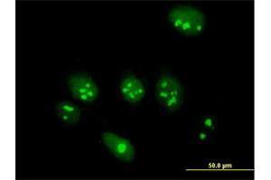 Immunofluorescence of purified MaxPab antibody to ABT1 on HeLa cell. (Activator of Basal Transcription 1 anticorps  (AA 1-272))