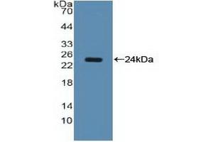 Western blot analysis of recombinant Human NCL. (Nucleolin anticorps  (AA 388-569))