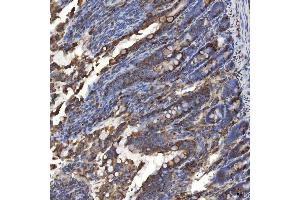 IHC analysis of TXNDC5 using anti-TXNDC5 antibody (ABIN7599699). (TXNDC5 anticorps  (AA 109-403))