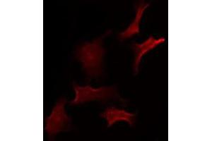 ABIN6275400 staining Hela by IF/ICC. (ZDHHC20 anticorps  (Internal Region))